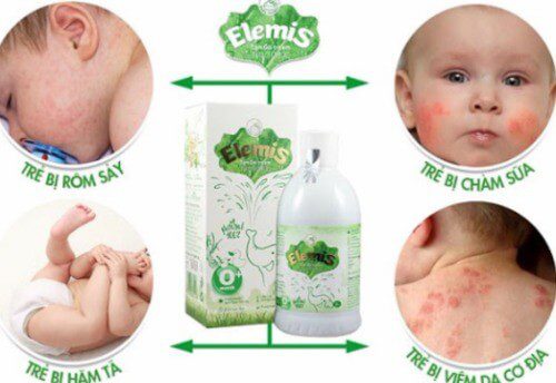 Elemis giúp giải quyết những vấn đề phổ biến ngoài da cho bé.