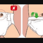 cách đóng bỉm cho trẻ sơ sinh chưa rụng rốn