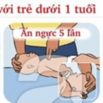 cách xử lý khi trẻ bị sặc sữa