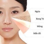 da mặt khô phải làm sao