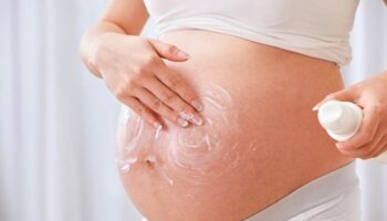 rạn da khi mang thai